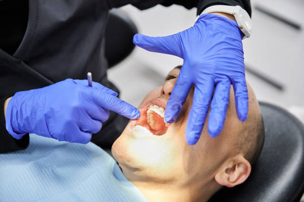 Best Emergency Dentist for Lost Fillings or Crowns in Marble Hill, MO